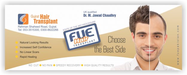 fue hair transplant cost in Pakistan, price hair transplant Pakistan, hair transplant before and after, cheap hair transplant, hair replacement, hair plantation, fue hair transplant reviews, fue hair transplant scars. Hair transplant surgery video, hair transplant surgery photos, hair transplant surgery recovery, hair transplant surgery YouTube, hair transplant surgery games, hair transplant surgery in turkey, hair transplant surgery pictures, hair transplant surgery cost.